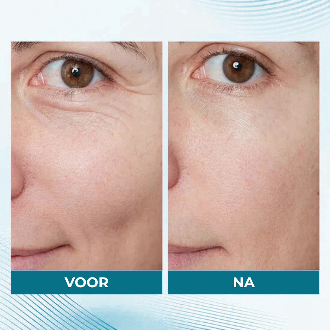 Healthbeam - Skin tightener
