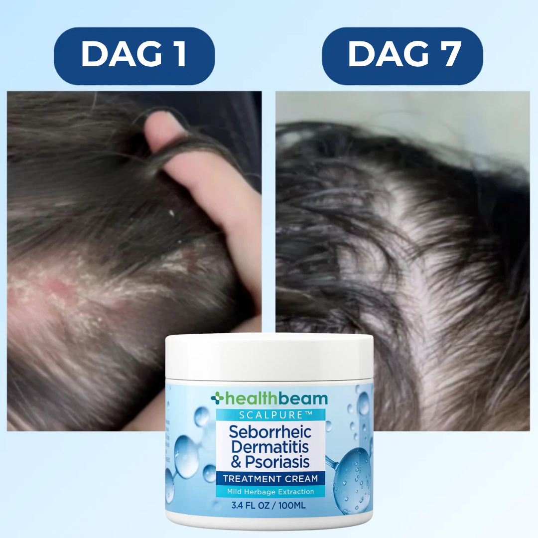 Healthbeam Scalp Relief