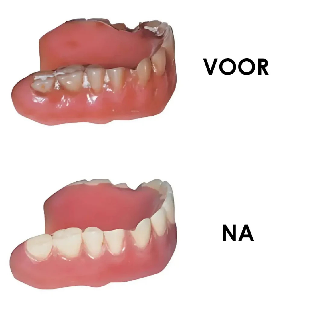 Denture Dome
