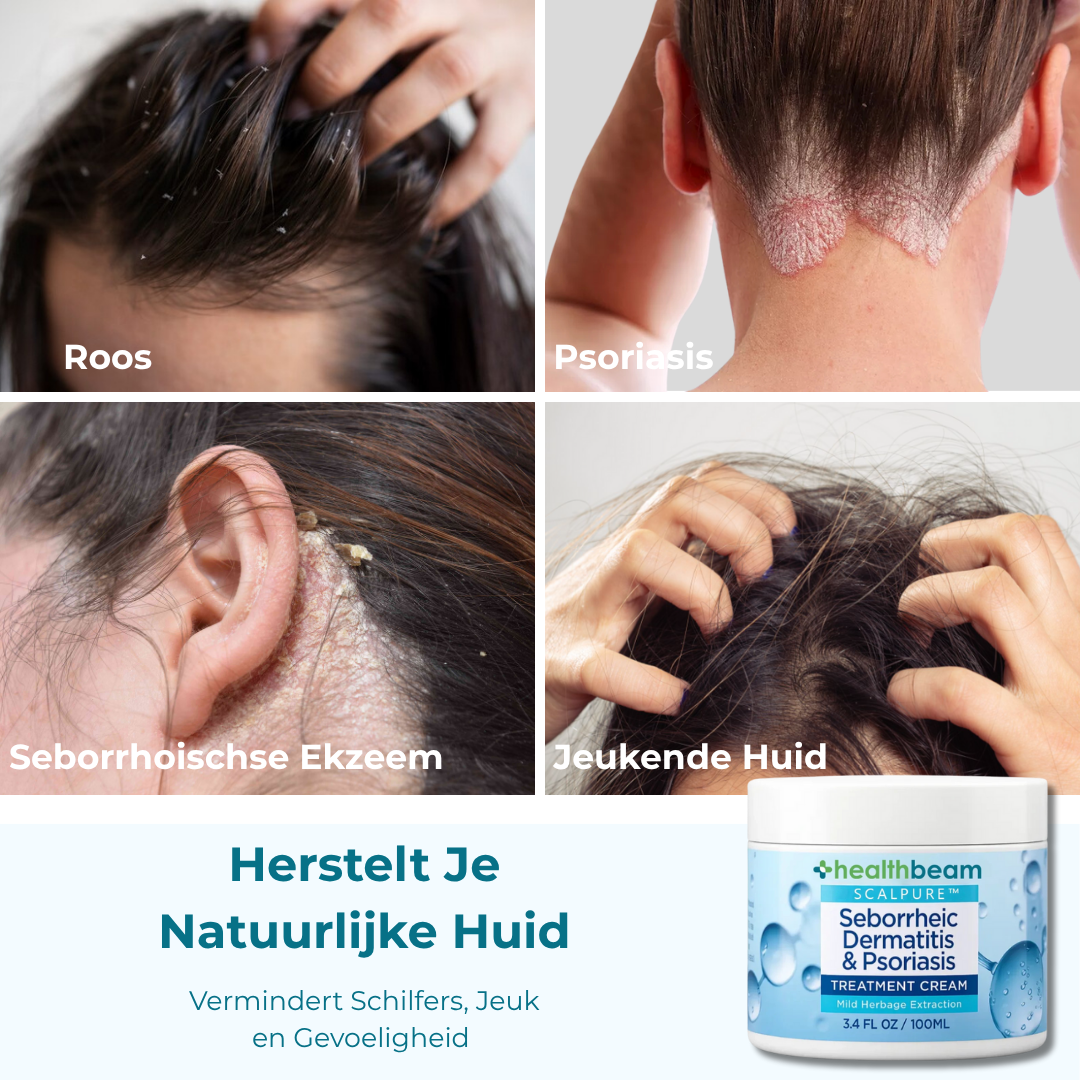 Healthbeam Scalp Relief