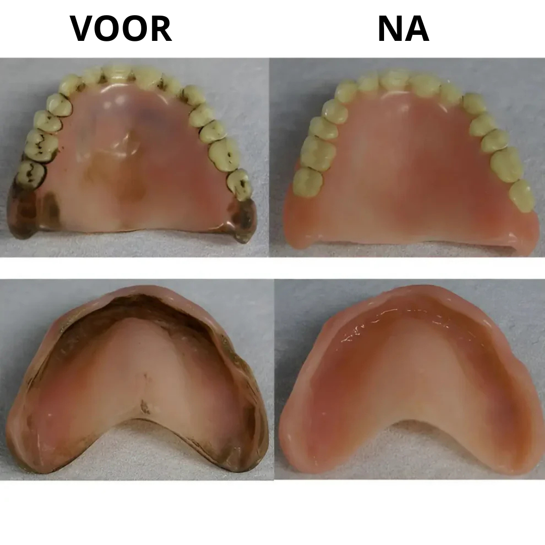 Denture Dome