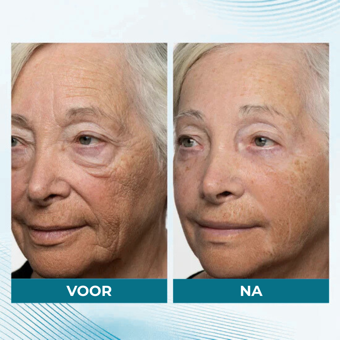 Healthbeam - Skin tightener
