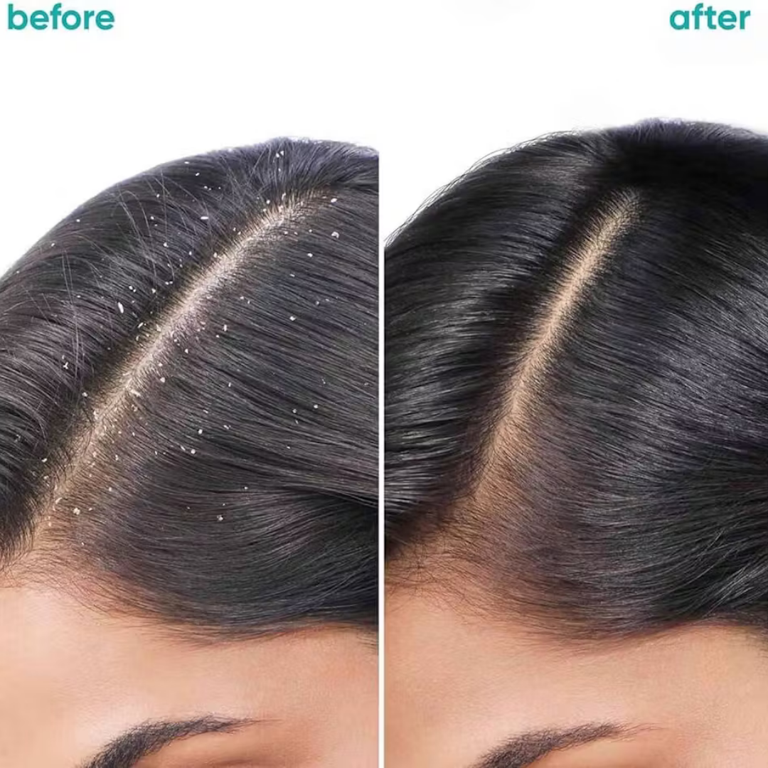Scalpure™ Soothing Scalp Balm