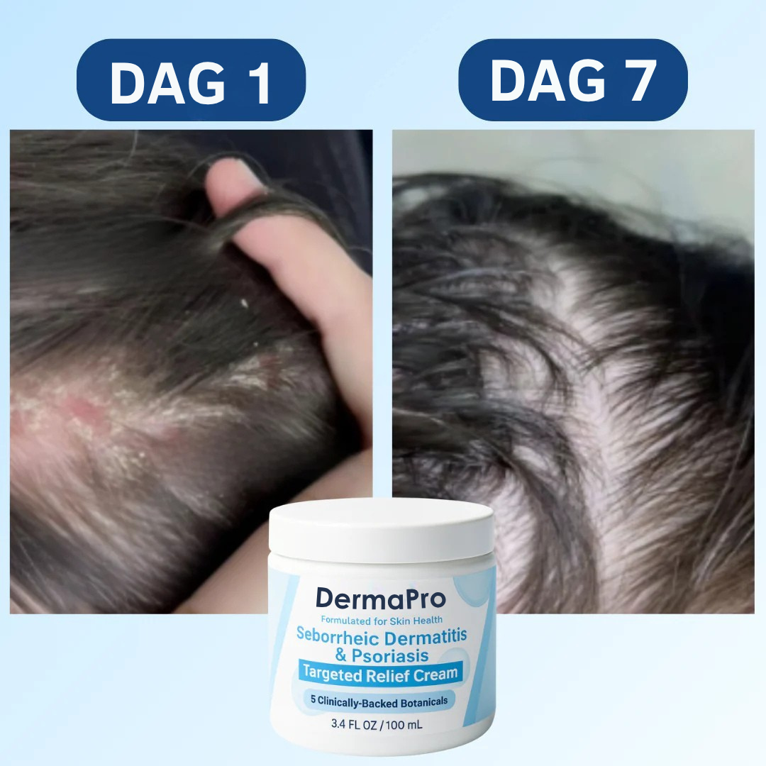 DermaPro Scalp Relief Crème